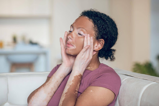 Personalised Vitiligo Treatment Plans