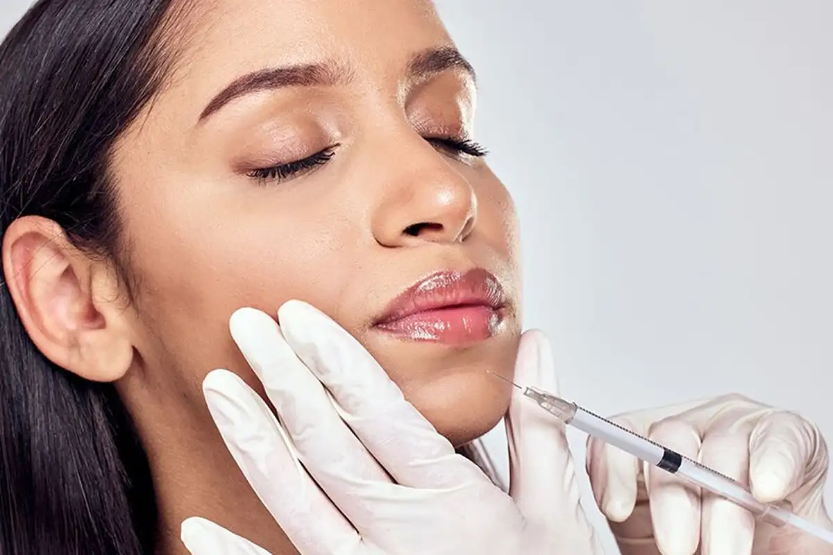 Dermal Fillers