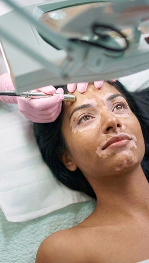 Reputed Skin Doctor for Vitiligo