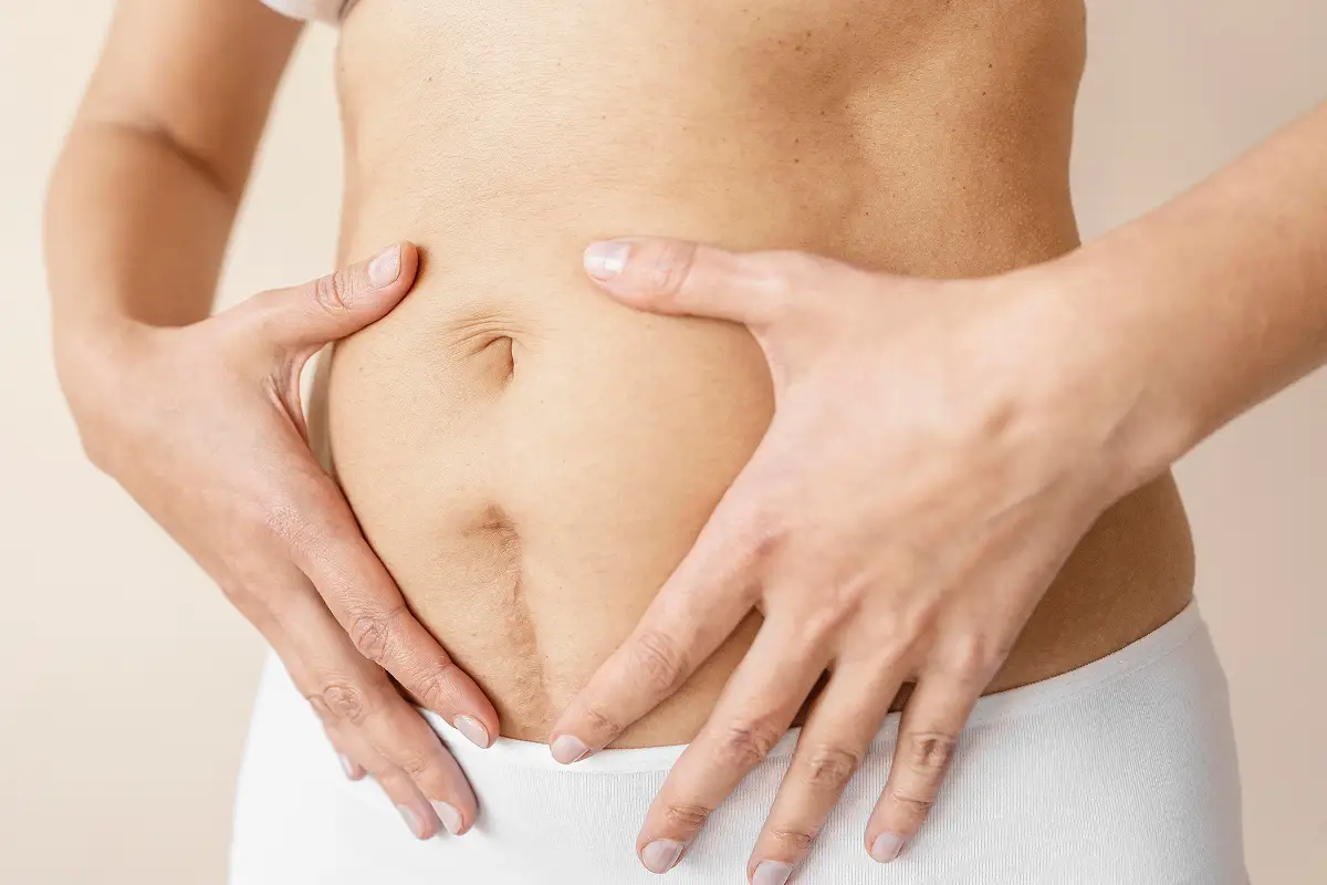 Scar Removal in Newtown