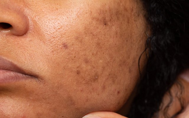 How Dermatology Treatments Actually Work